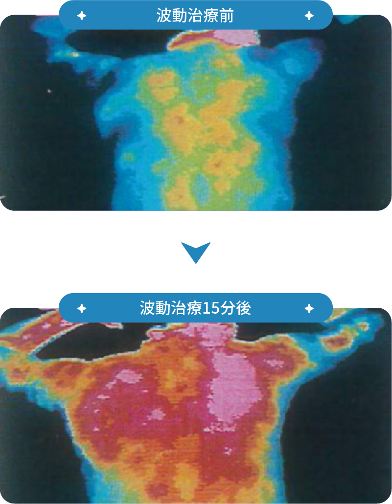 血流量の増加